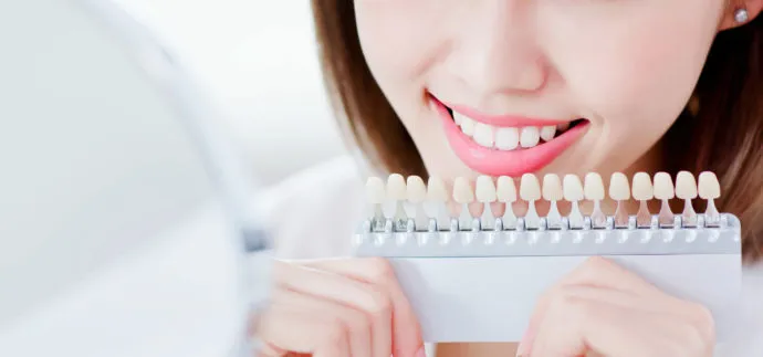 Vor dem Home-Bleaching ist die Bestimmung der Ausgangsfarbe wichtig, um den späteren Farbunterschied in Relation zu dieser setzen zu können.