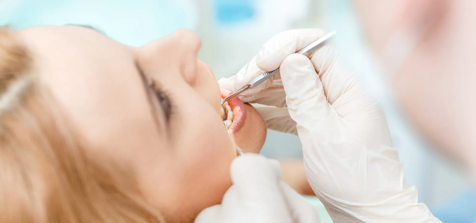 Vorbereitung auf ein Zahnbleaching zu Hause Vorbereitung auf ein Zahnbleaching zu Hause